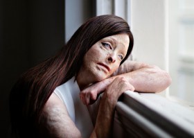 Martina Holmberg's portrait Mel has won the 2025 Taylor Wessing Photo Portrait Prize. Photo: Martina Holmberg.