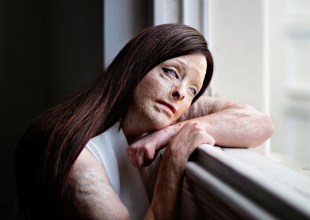 Martina Holmberg's portrait Mel has won the 2025 Taylor Wessing Photo Portrait Prize. Photo: Martina Holmberg.